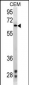 ZAP70 Antibody (Ascites)